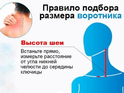 Патологии шейного отдела позвоночника: причины нарушений